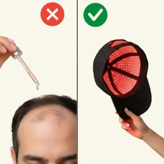 Casquette LED vs minoxidil vs shampoings fortifiants : comparatif