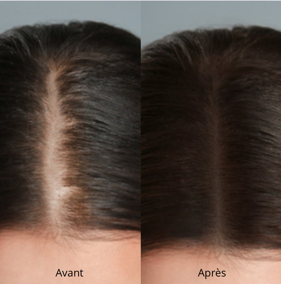 Casquette LED Douciane - Anti-chute et repousse cheveux