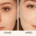 Avant après l’option hydratante Douciane 