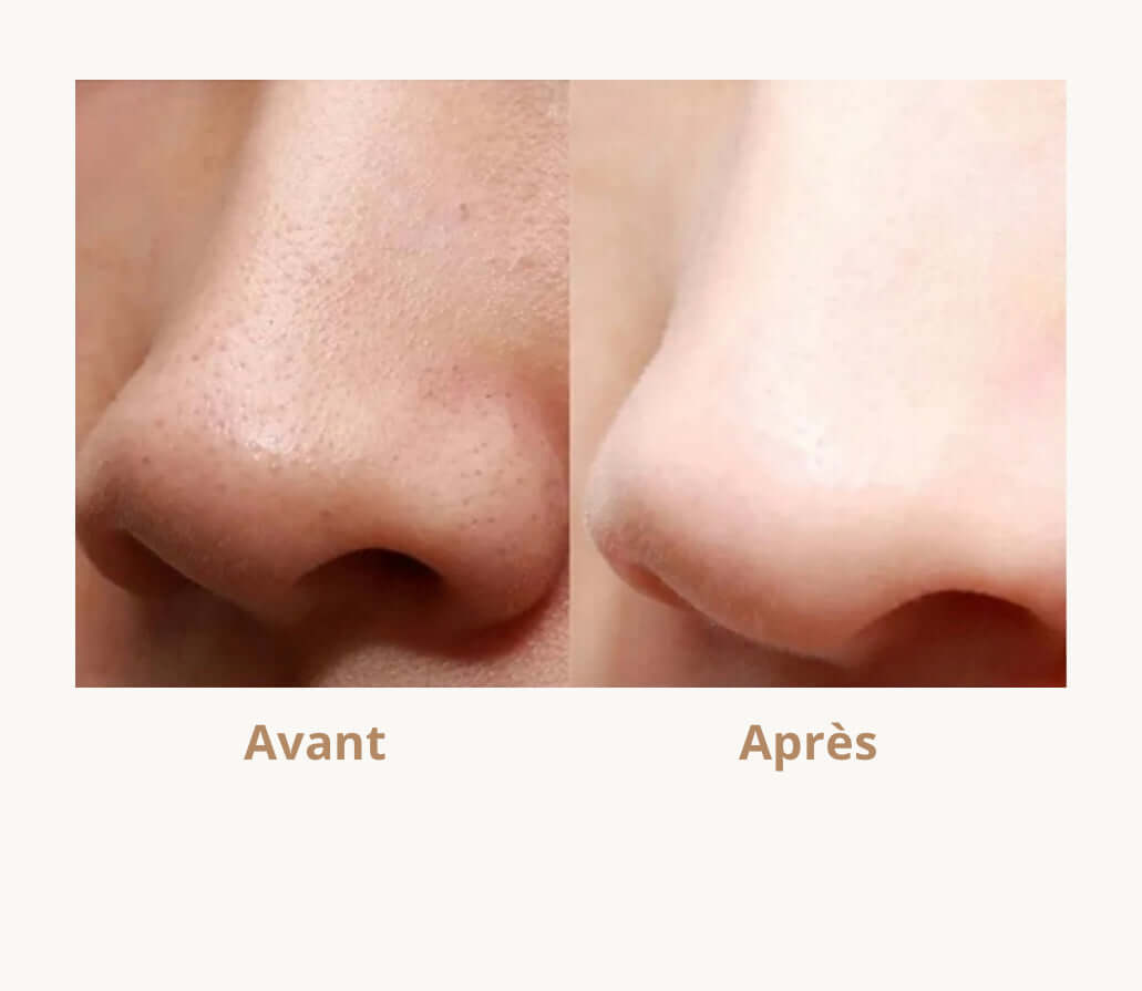 Avant après spatule visage Douciane 