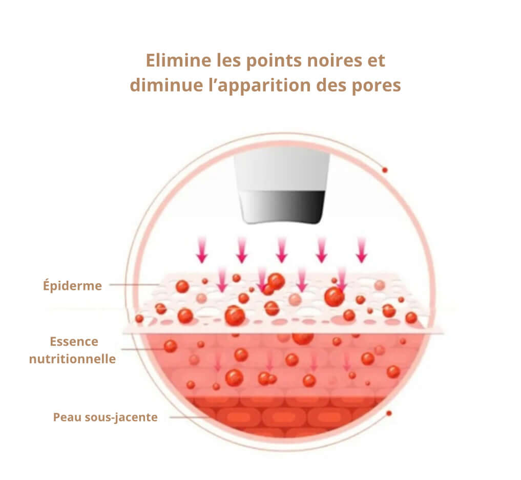 Explication peau spatule visage Douciane 