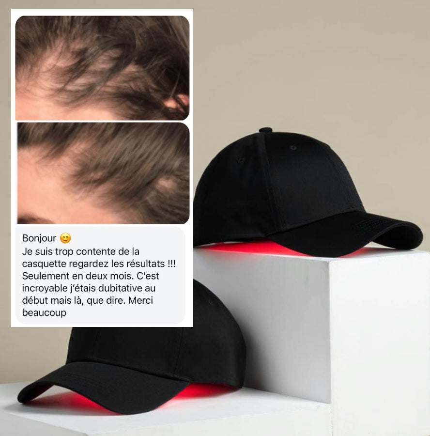 Casquette LED Douciane - Anti-chute et repousse cheveux