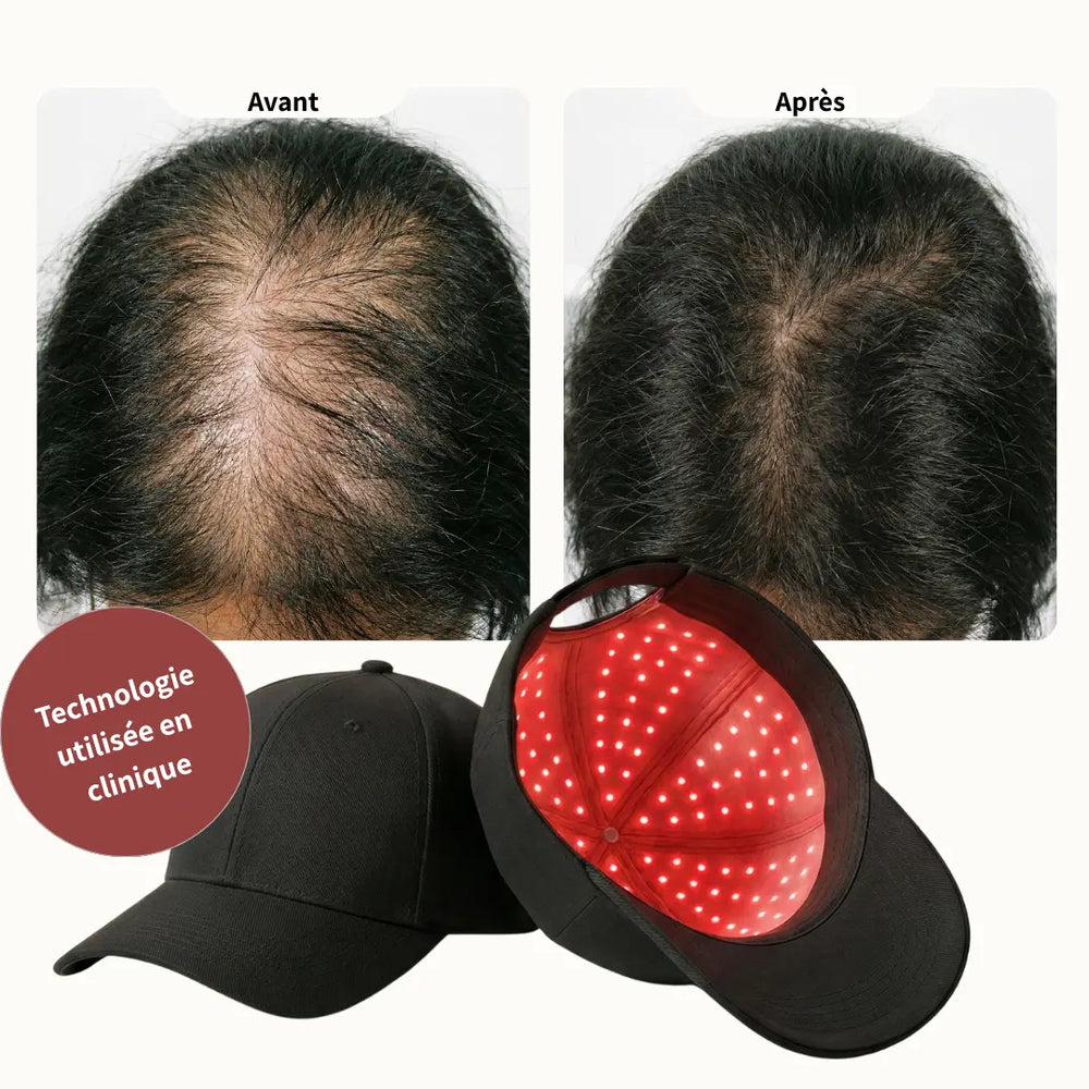 Vos cheveux arrêtent de tomber dès les premières semaines