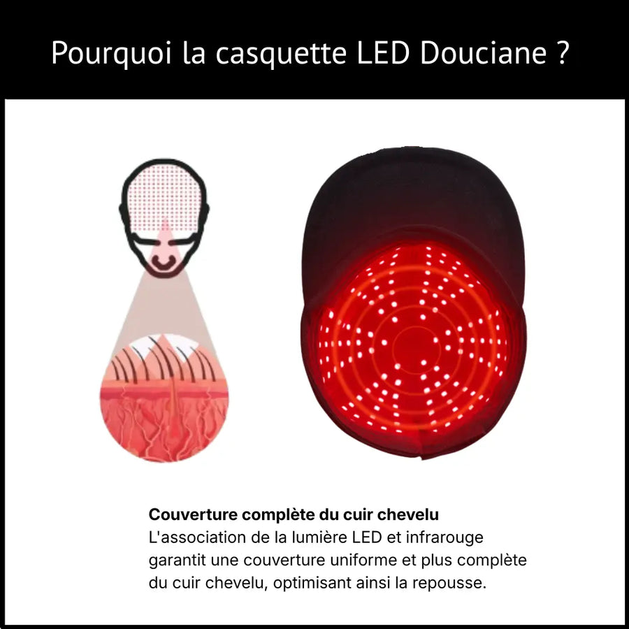 Comment se procurer la casquette LED Douciane, s'il en reste encore...