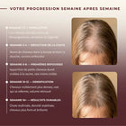 Brosse à cheveux à lumière LED - Stimuler la repousse des cheveux
