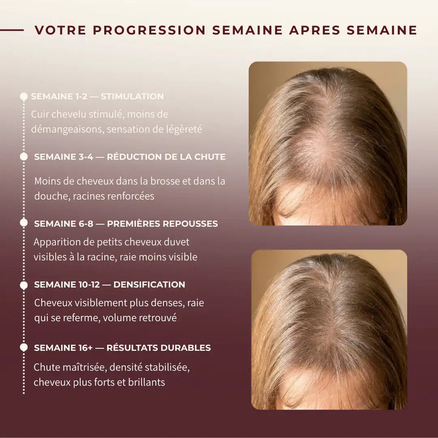 Brosse à cheveux à lumière LED - Stimuler la repousse des cheveux