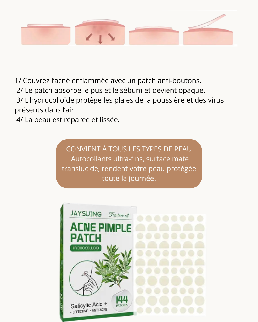 Patch Anti-Acné Hydrocolloïde – 144 pièces