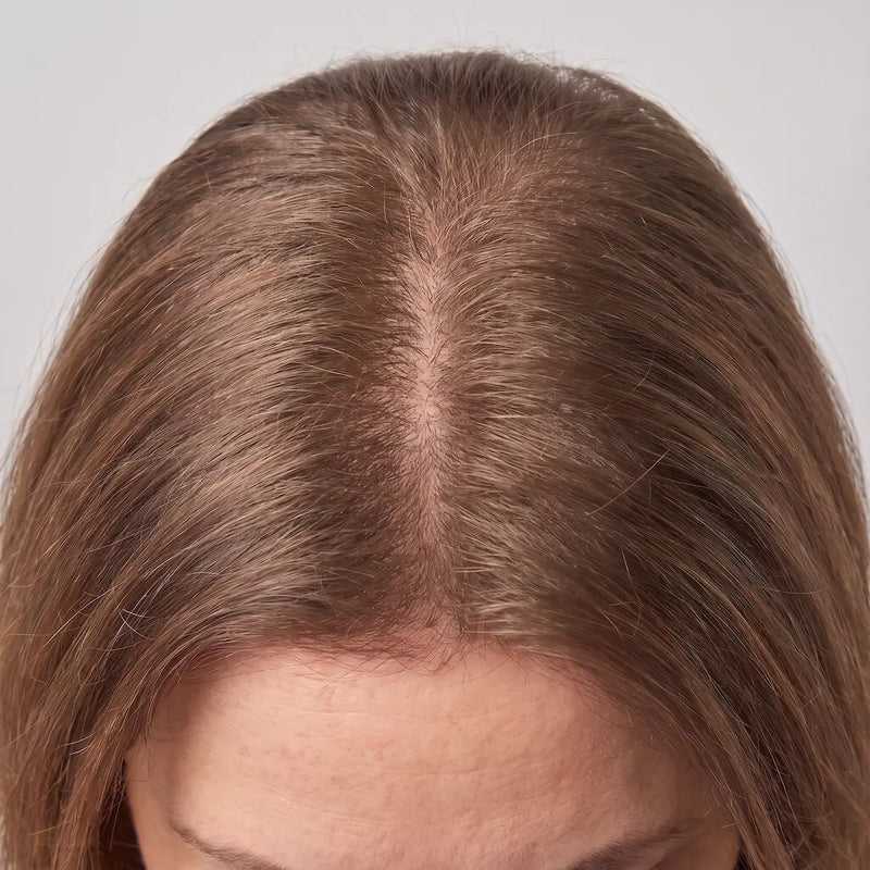 AFTER — Day 90
