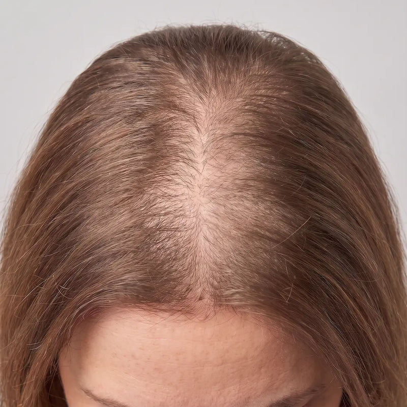 BEFORE — Day 0