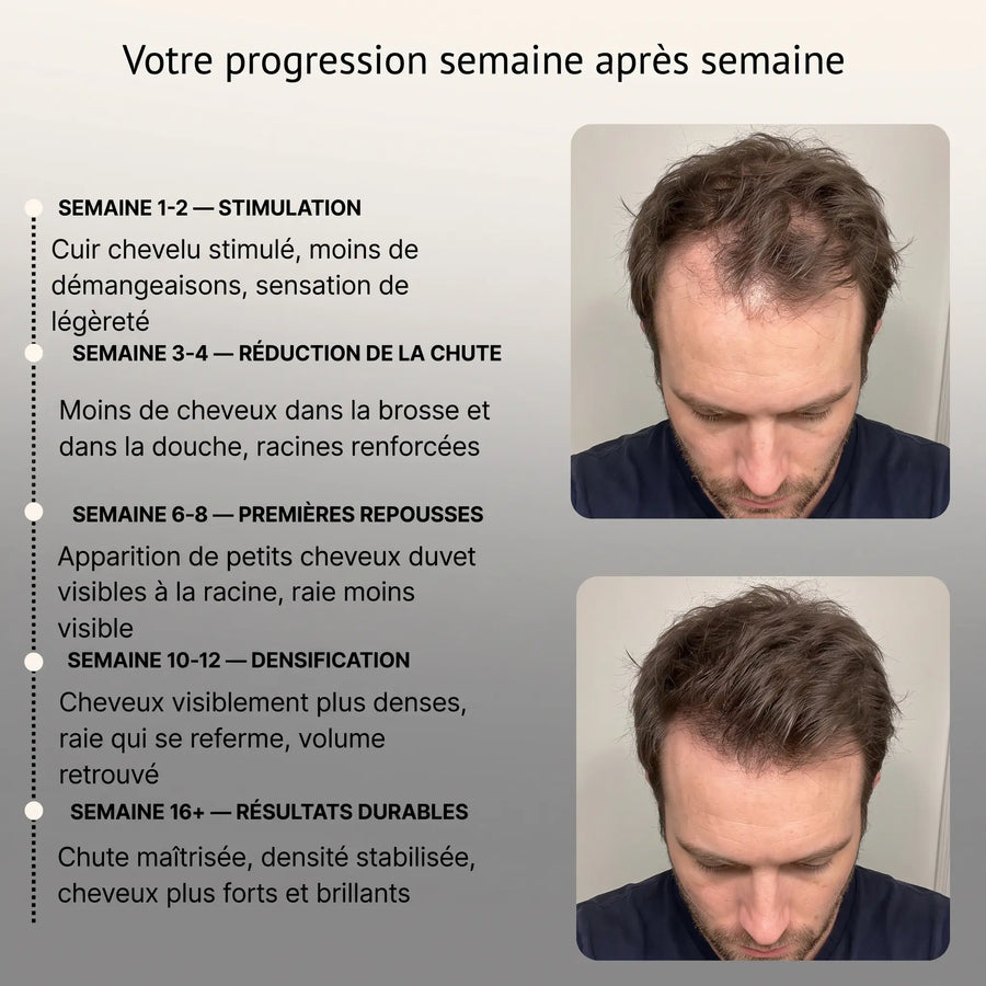 Brosse à cheveux à lumière LED - Stimuler la repousse des cheveux